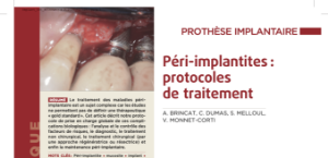 Implant_105_Brincat (1)